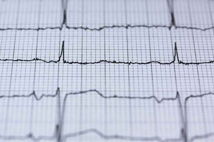 blur chart check up curve